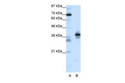 Antibody used in WB on Human Jurkat 1.25 ug/ml.