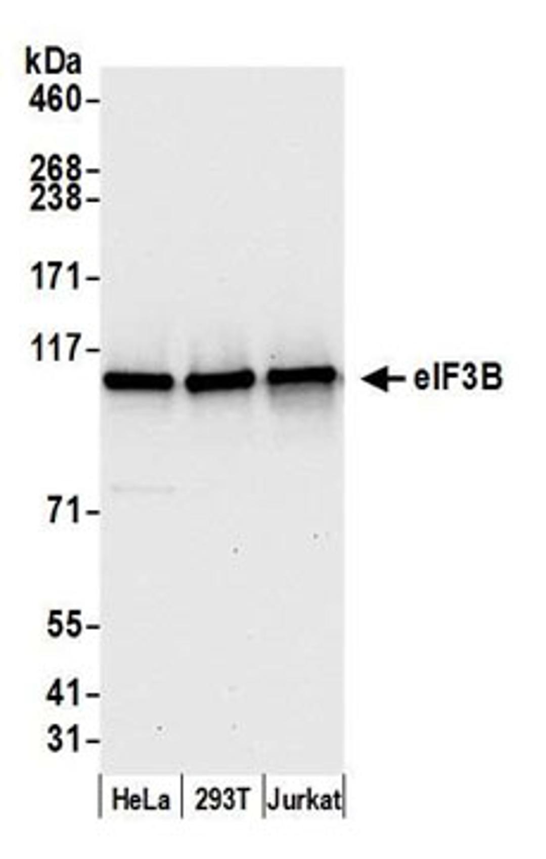 Detection of human eIF3B by western blot.