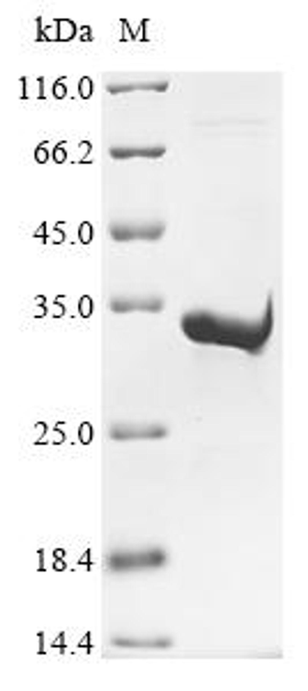 (Tris-Glycine gel) Discontinuous SDS-PAGE (reduced) with 5% enrichment gel and 15% separation gel.