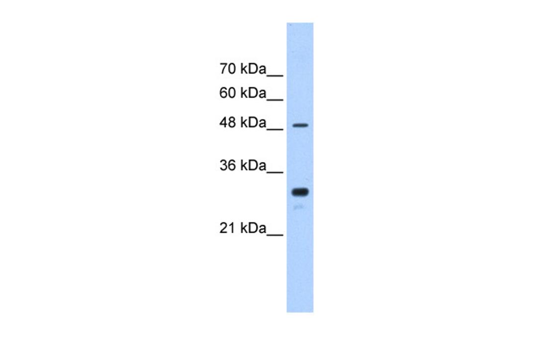 Antibody used in WB on Human Jurkat 0.2-1 ug/ml.