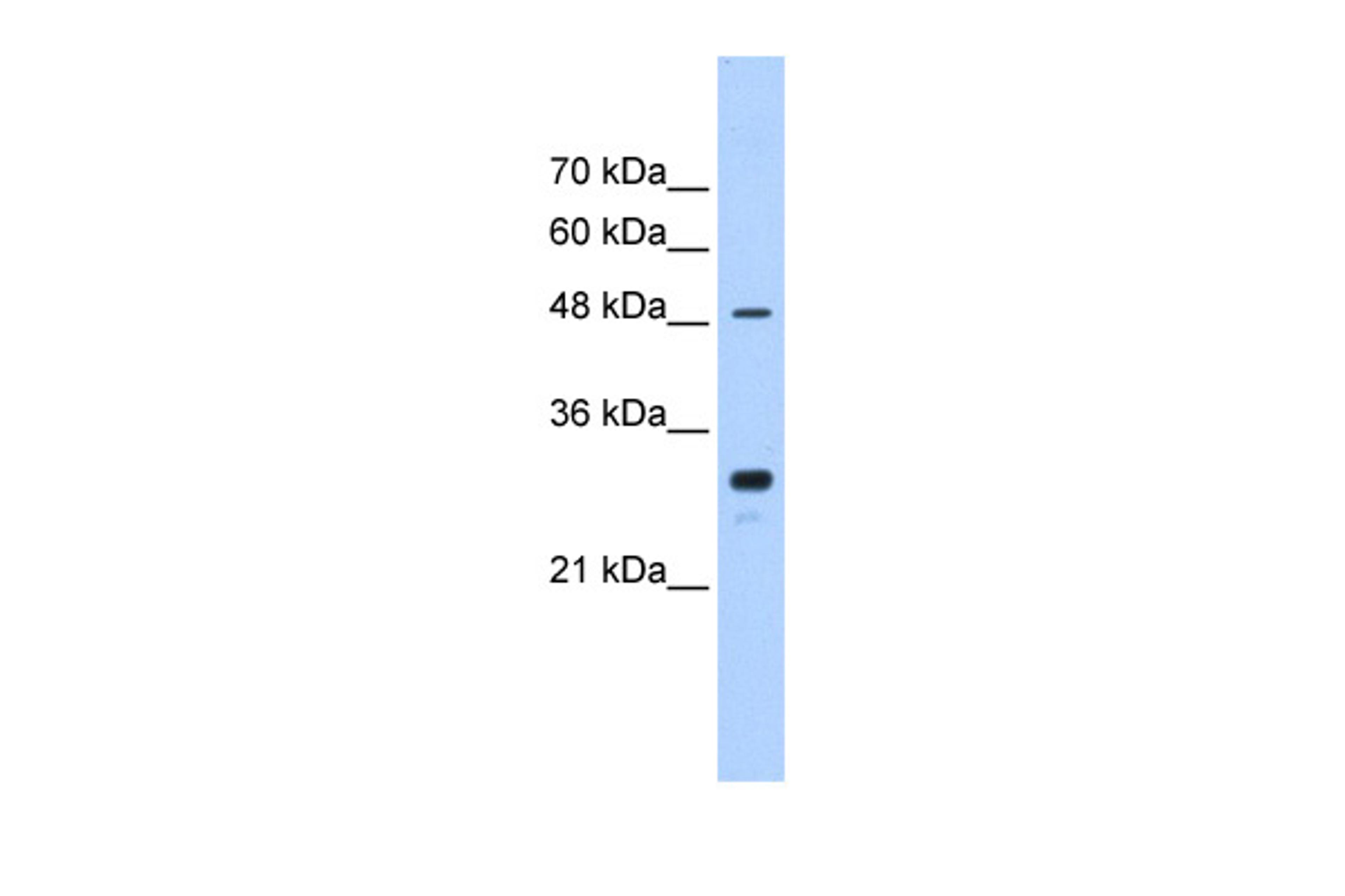 Antibody used in WB on Human Jurkat 0.2-1 ug/ml.