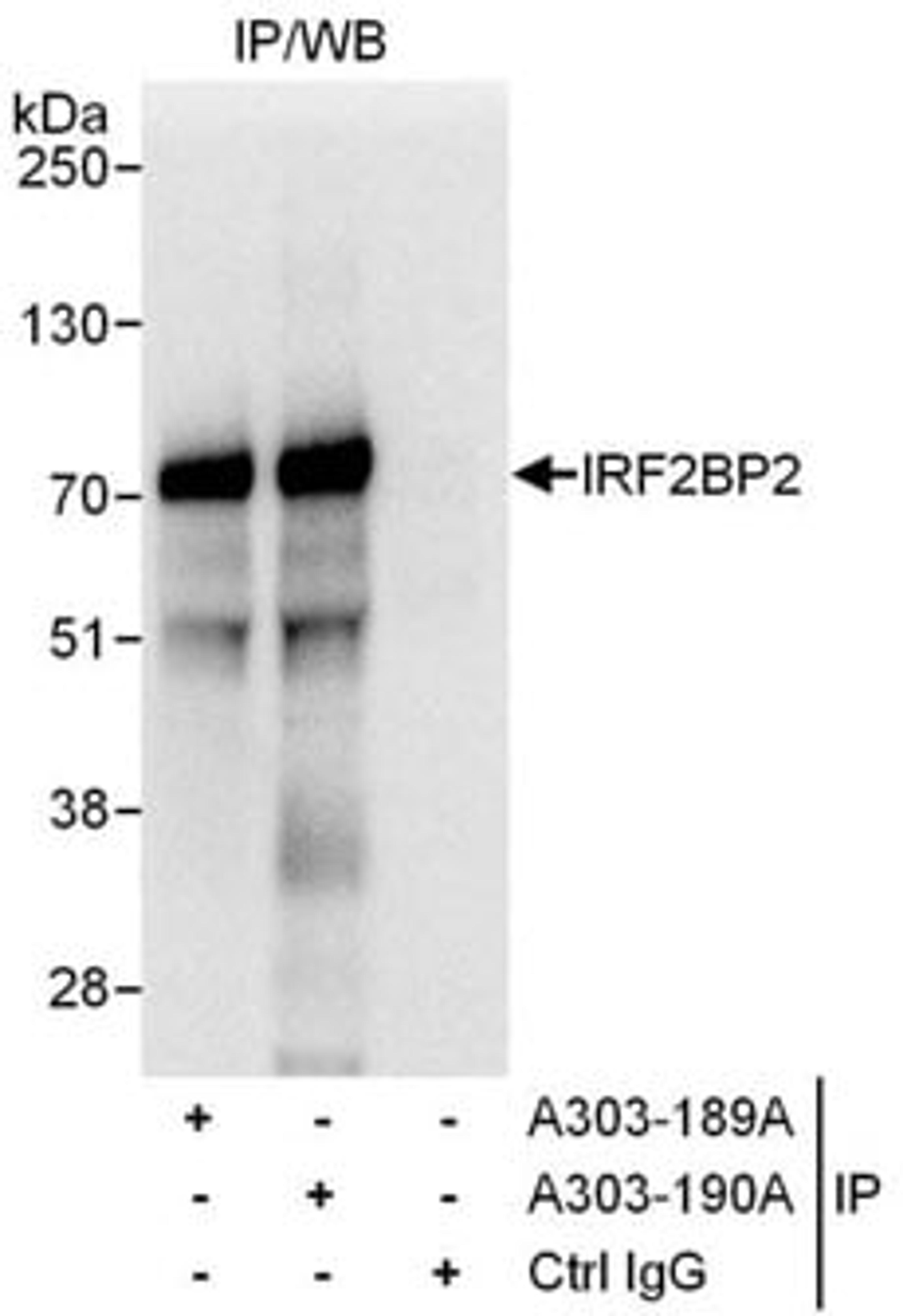 Detection of human IRF2BP2 by western blot of immunoprecipitates.