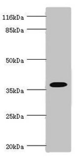 Western blot. All lanes: FBP1 antibody at 3.06ug/ml. Lane 1: Mouse liver tissue. Lane 2: Mouse kidney tissue. Secondary. Goat polyclonal to rabbit IgG at 1/10000 dilution. Predicted band size: 37 kDa. Observed band size: 37 kDa.