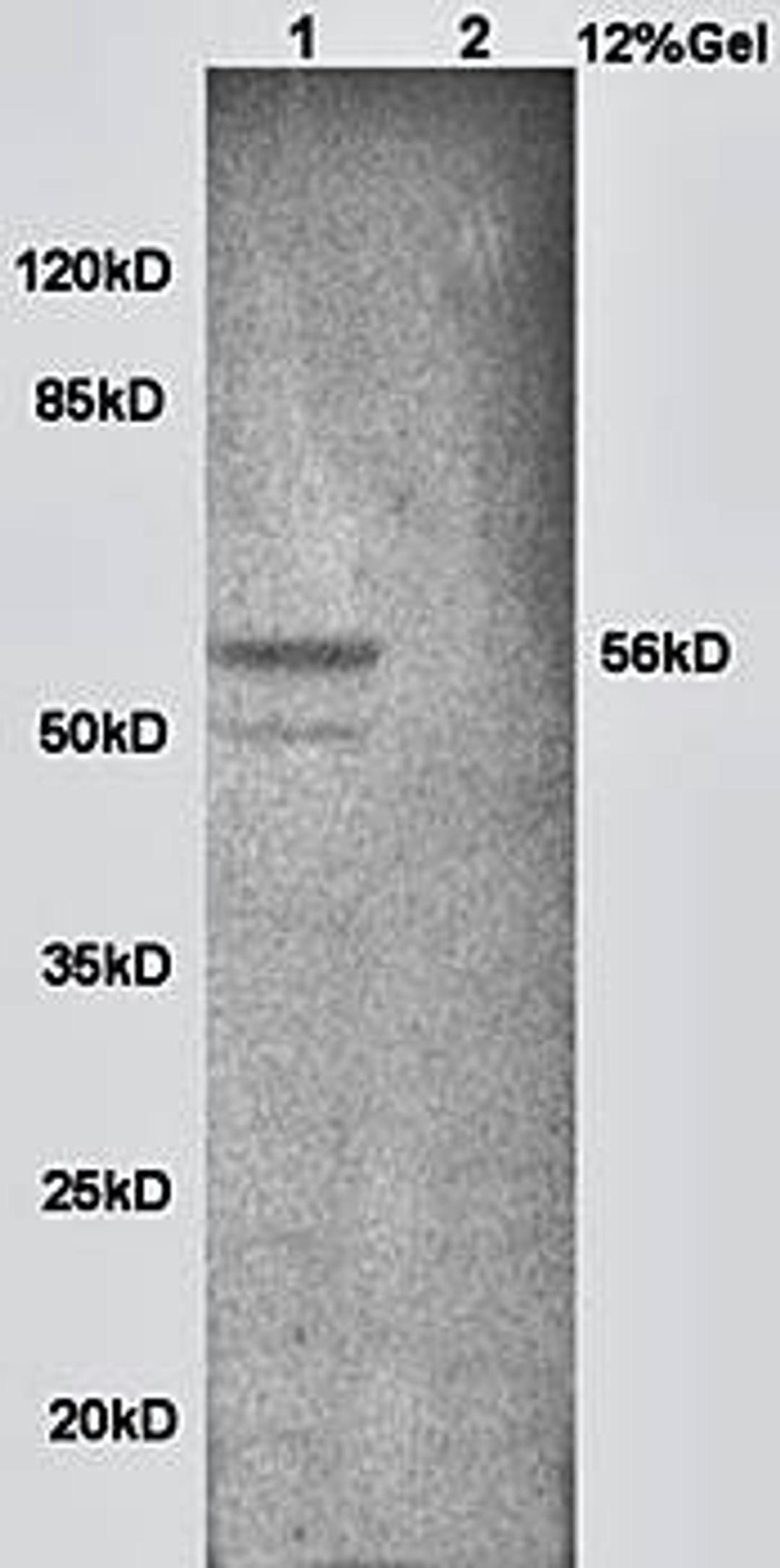 Western blot analysis of mouse brain lysates (Lane1), ouse heart lysates (Lane2) Dilution at:1:200 using AP/ALP antibody