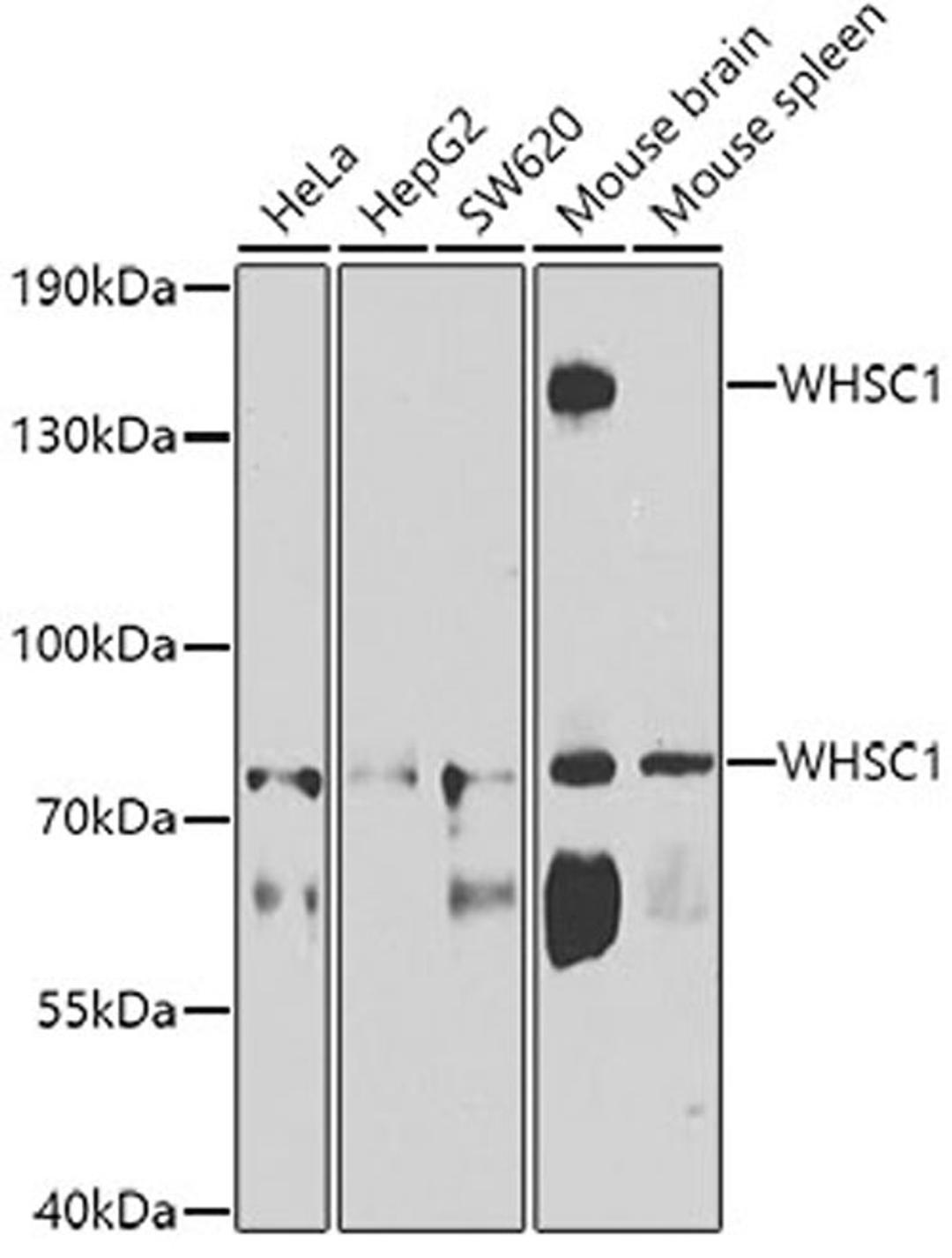 Western blot - WHSC1 antibody (A7938)