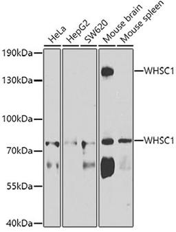 Western blot - WHSC1 antibody (A7938)