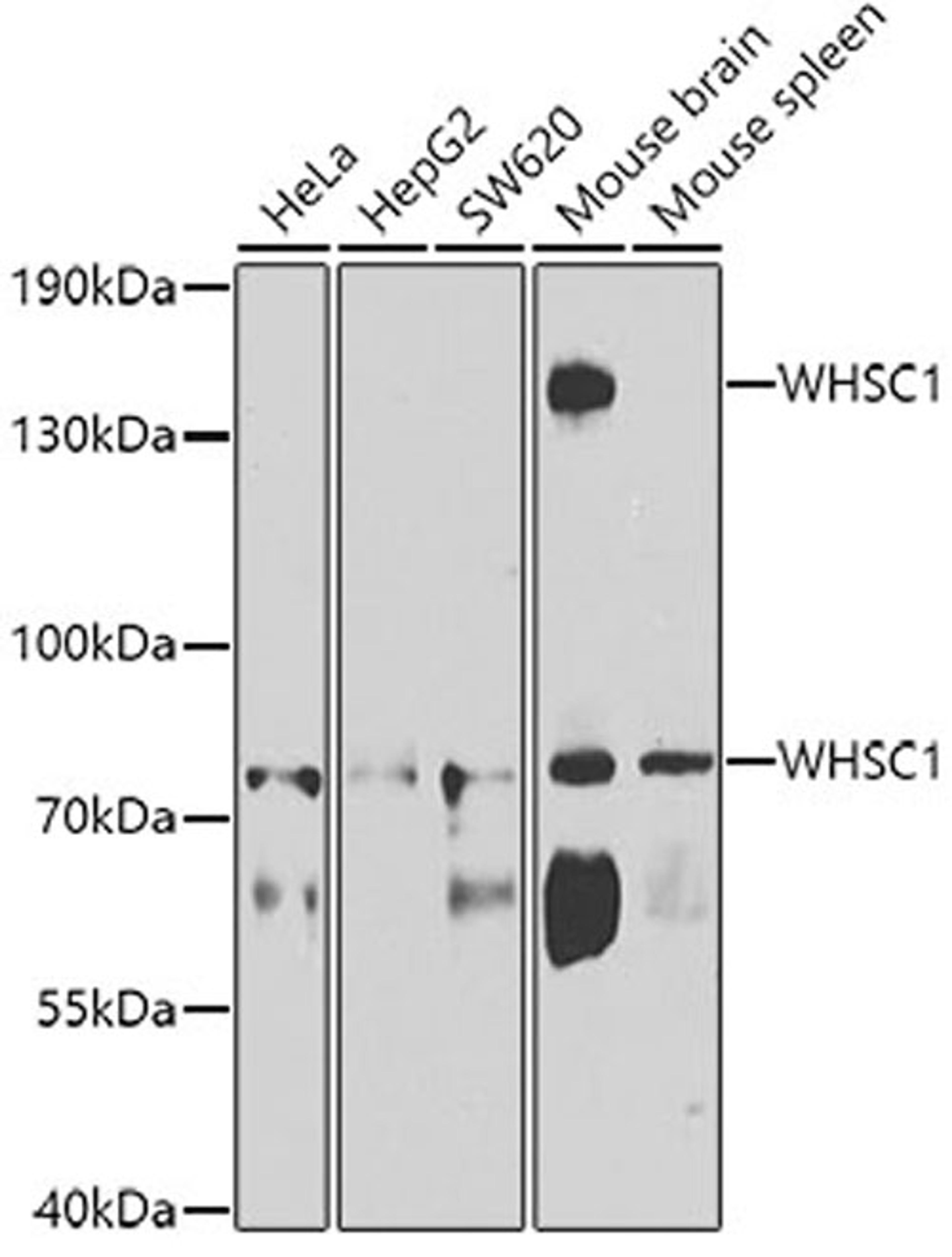 Western blot - WHSC1 antibody (A7938)