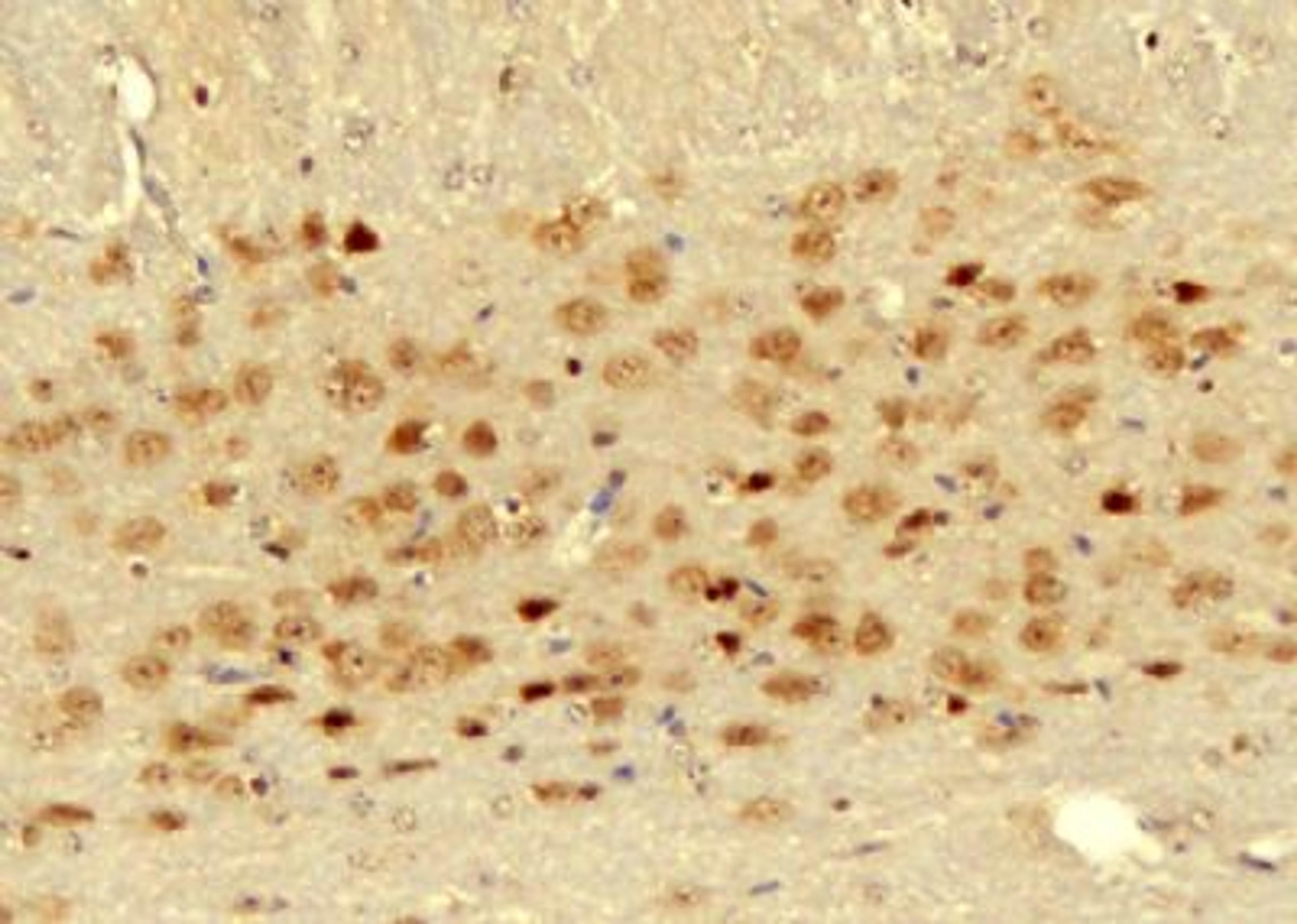 Immunohistochemical staining of Mouse brain tissue using GLUT1 antibody.