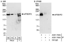 Detection of human eIF5B/IF2 by western blot and immunoprecipitation.