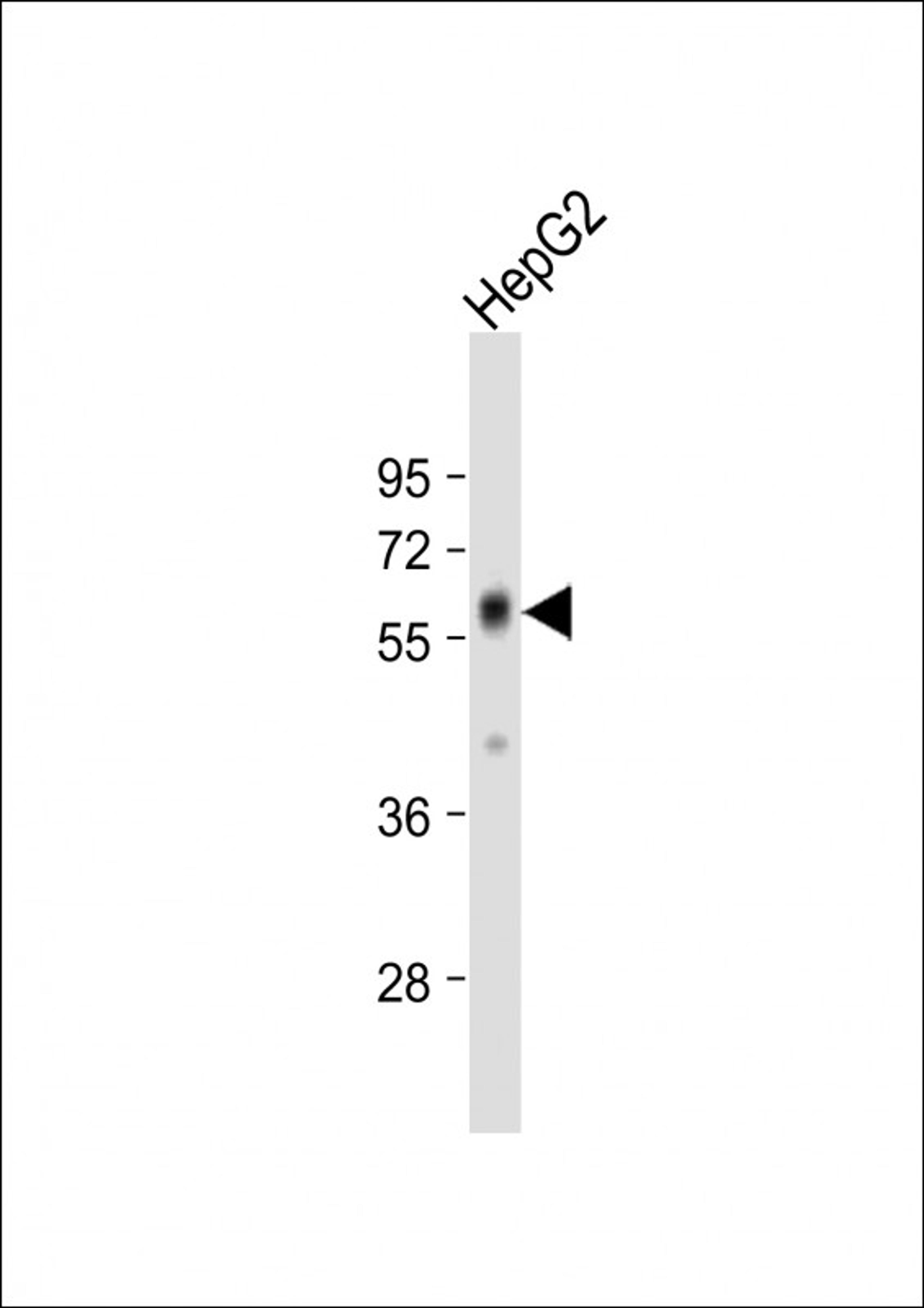 Western Blot at 1:1000 dilution + HepG2 whole cell lysate Lysates/proteins at 20 ug per lane.