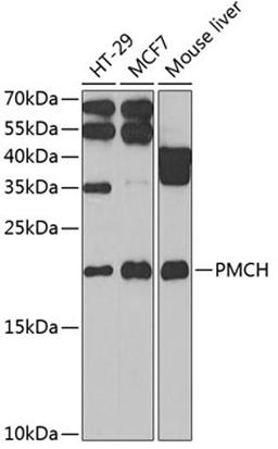 Western blot - PMCH antibody (A6692)