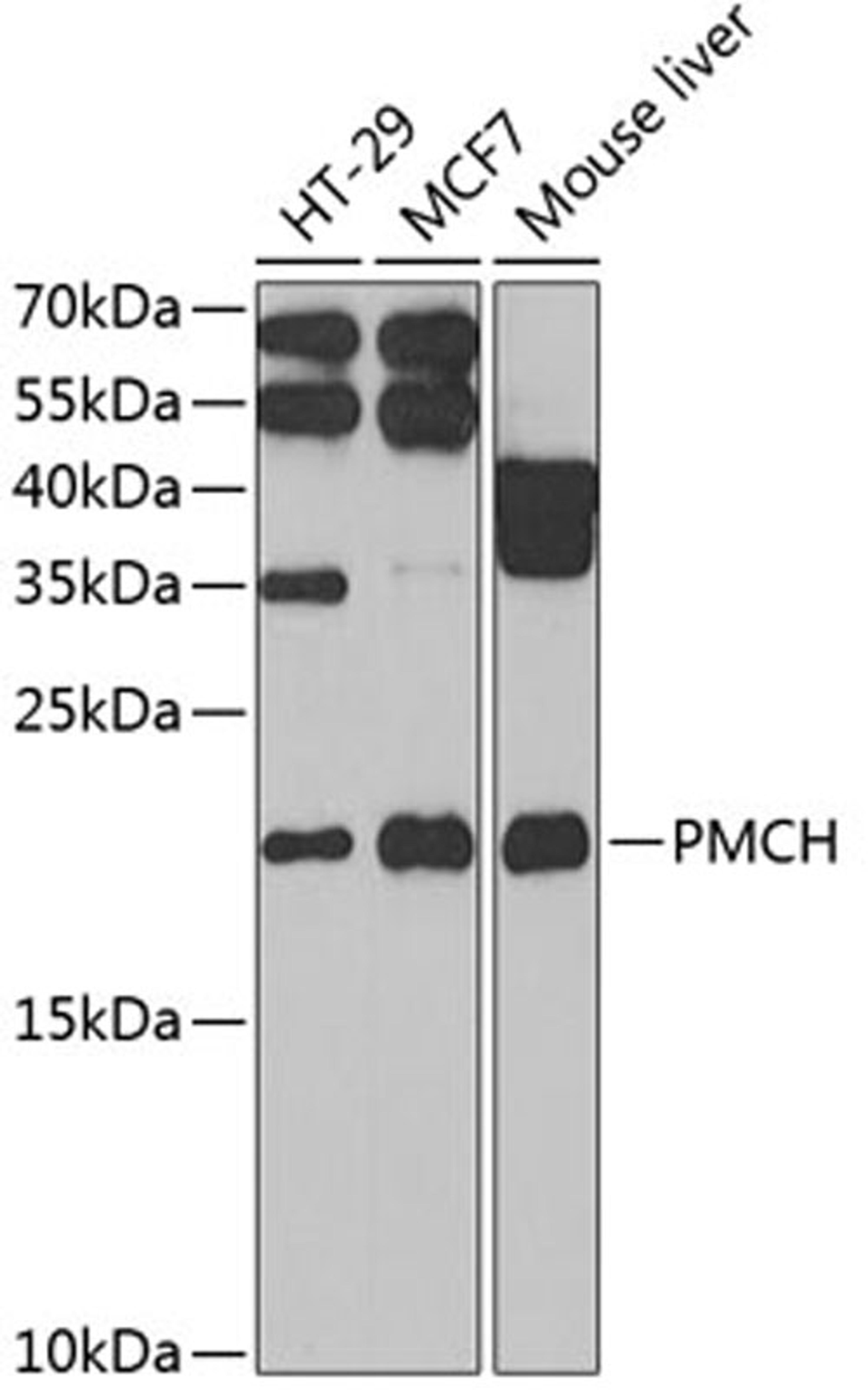 Western blot - PMCH antibody (A6692)