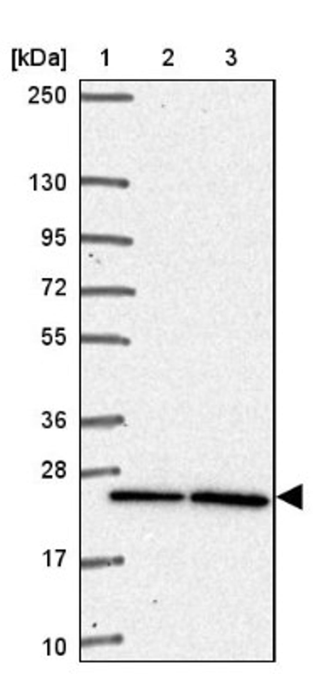 Western Blot: PQLC2 Antibody [NBP2-34085] - Lane 1: Marker [kDa] 250, 130, 95, 72, 55, 36, 28, 17, 10<br/>Lane 2: Human cell line RT-4<br/>Lane 3: Human cell line U-251MG sp