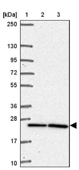 Western Blot: PQLC2 Antibody [NBP2-34085] - Lane 1: Marker [kDa] 250, 130, 95, 72, 55, 36, 28, 17, 10<br/>Lane 2: Human cell line RT-4<br/>Lane 3: Human cell line U-251MG sp