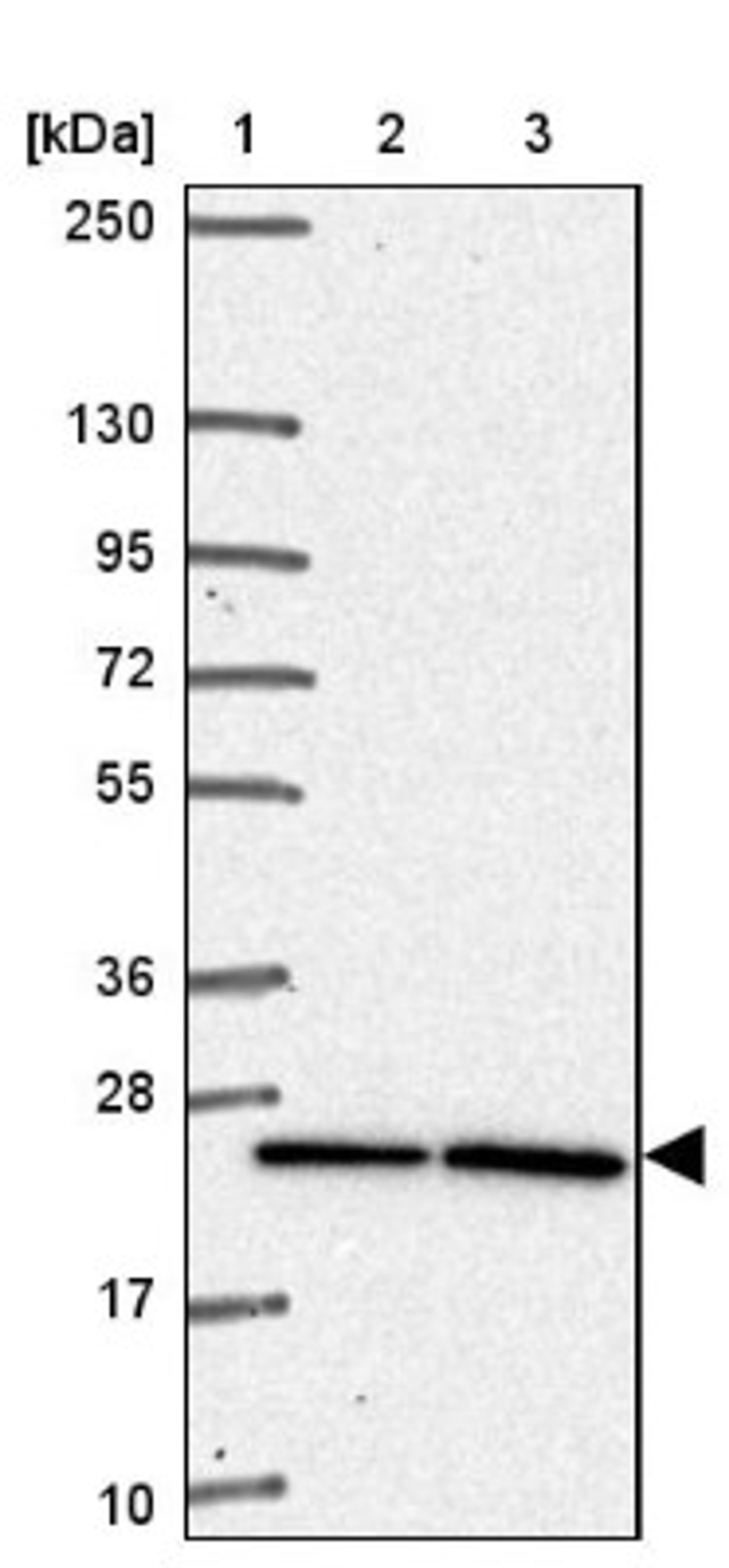 Western Blot: PQLC2 Antibody [NBP2-34085] - Lane 1: Marker [kDa] 250, 130, 95, 72, 55, 36, 28, 17, 10<br/>Lane 2: Human cell line RT-4<br/>Lane 3: Human cell line U-251MG sp