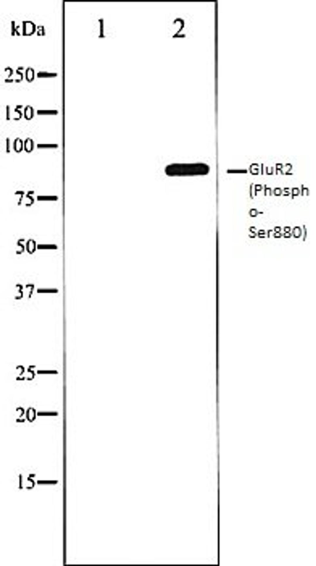 Western blot analysis of Mouse brain tissue lysates using GluR2 (Phospho-Ser880) antibody, The lane on the left is treated with the antigen-specific peptide.