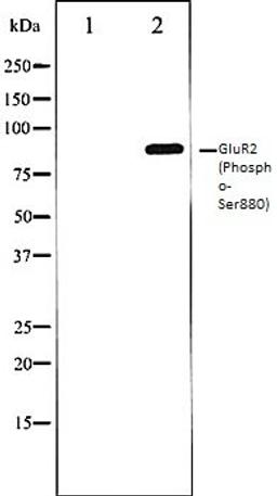 Western blot analysis of Mouse brain tissue lysates using GluR2 (Phospho-Ser880) antibody, The lane on the left is treated with the antigen-specific peptide.