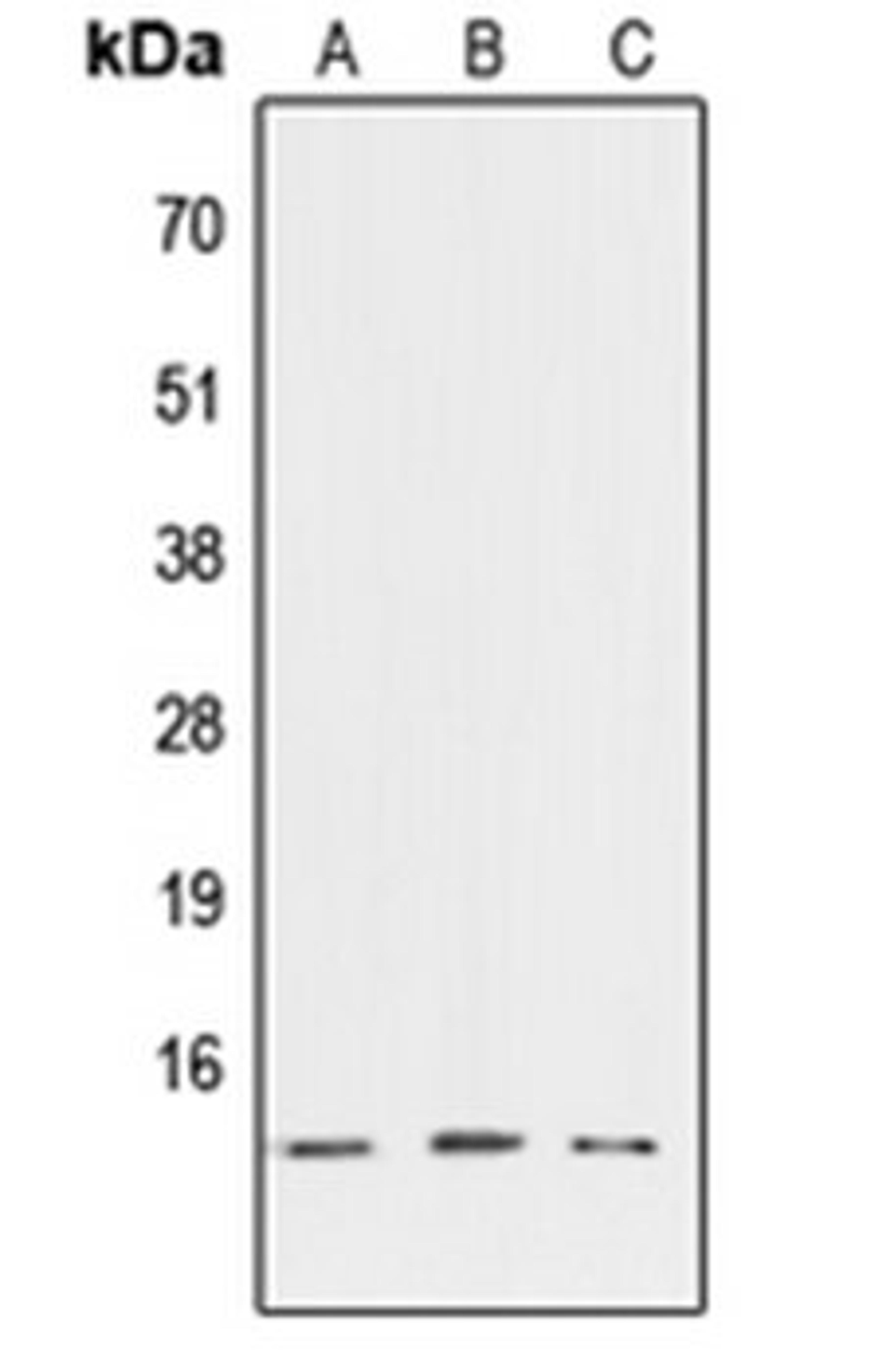 Western blot analysis of HEK293T (Lane 1), NIH3T3 (Lane 2), PC12 (Lane 3) whole cell lysates using ATP6V1G3 antibody