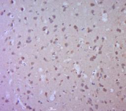 Immunohistochemical staining of Mouse brain tissue using Synaptophysin antibody.