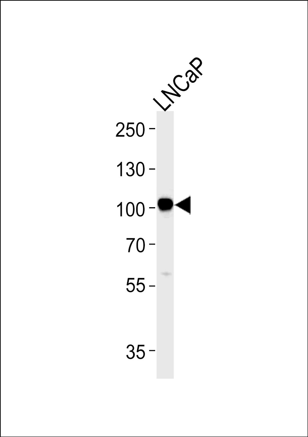 Western blot analysis in LNCaP cell line lysates (35ug/lane).