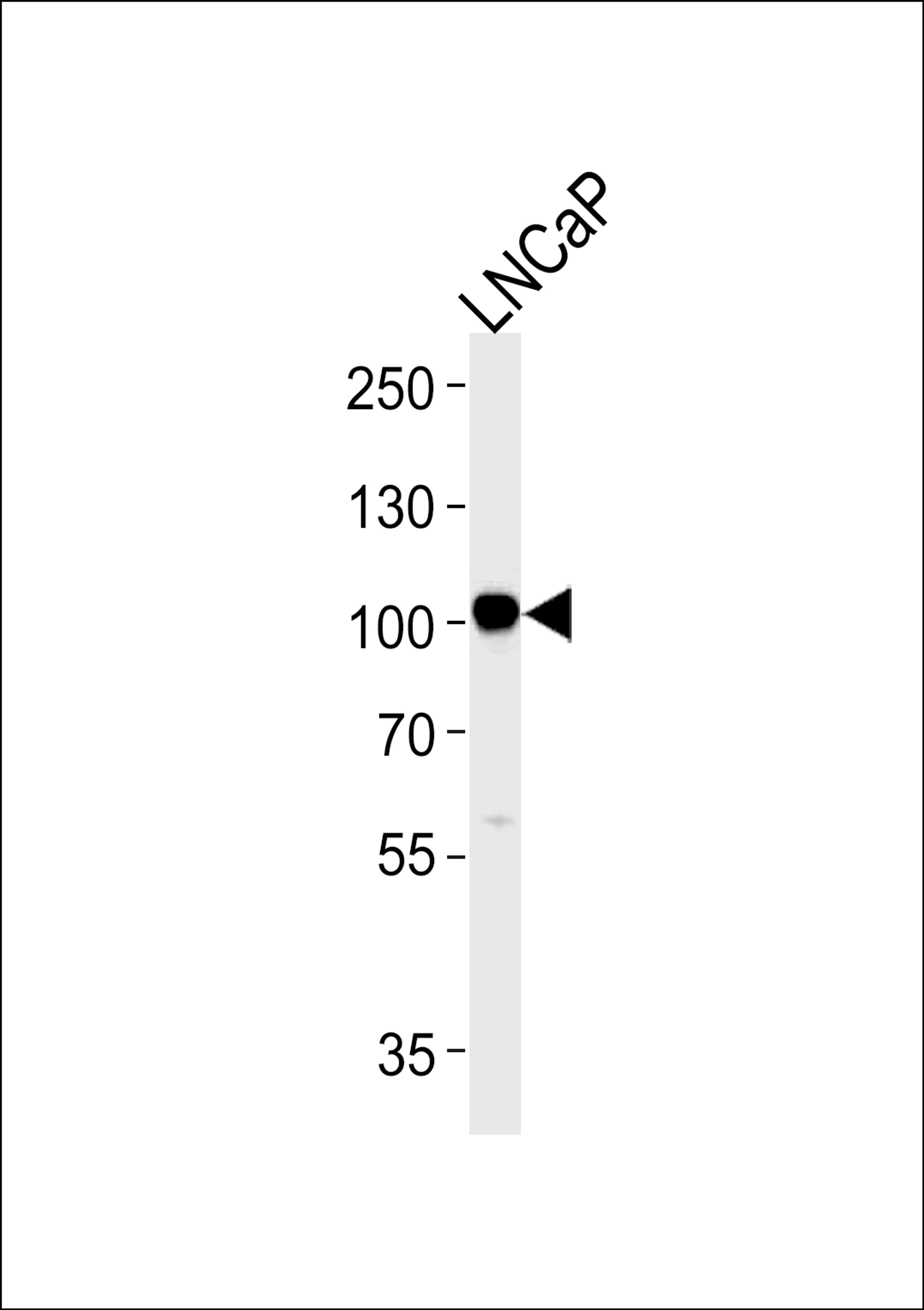 Western blot analysis in LNCaP cell line lysates (35ug/lane).