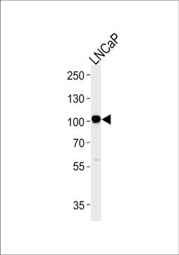 Western blot analysis in LNCaP cell line lysates (35ug/lane).