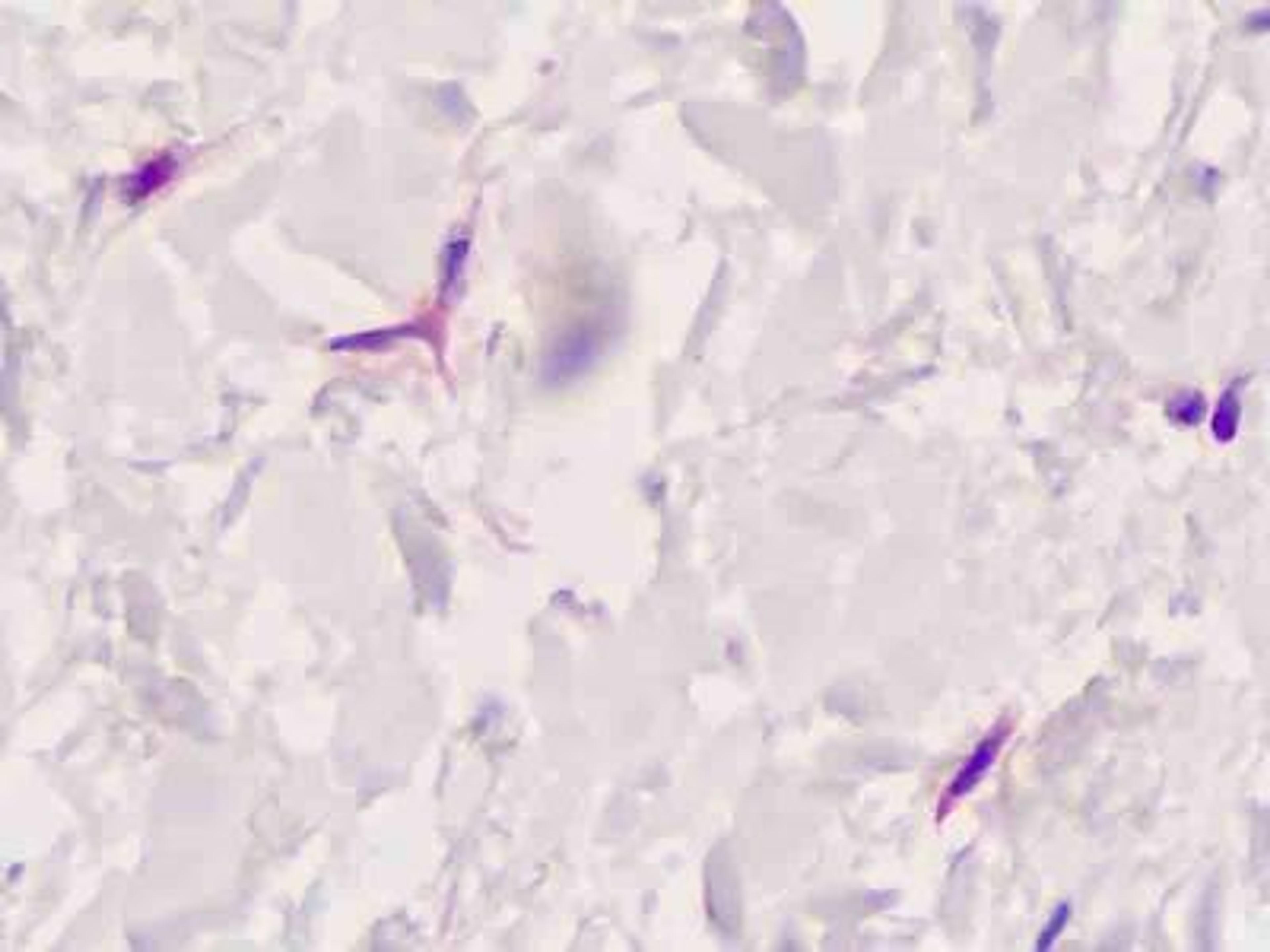 Immunohistochemistry-Paraffin: Fibroblast Activation Protein alpha/FAP Antibody [NB100-58755] - Analysis of anti-FAP antibody with human skin, dermal fibroblasts.