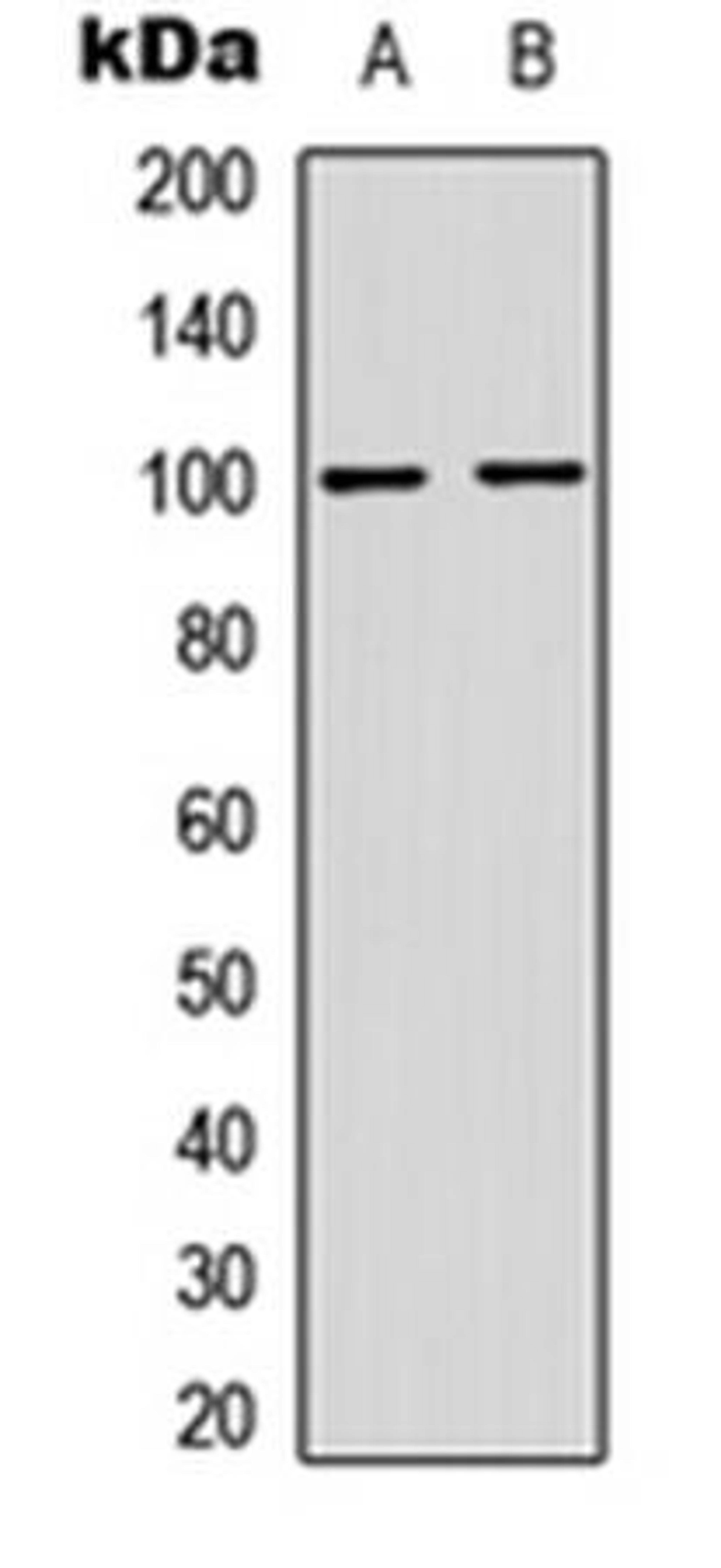 Western blot analysis of HeLa (Lane1), MCF7 (Lane2) whole cell using NF-kappaB p100 (phospho-S865) antibody