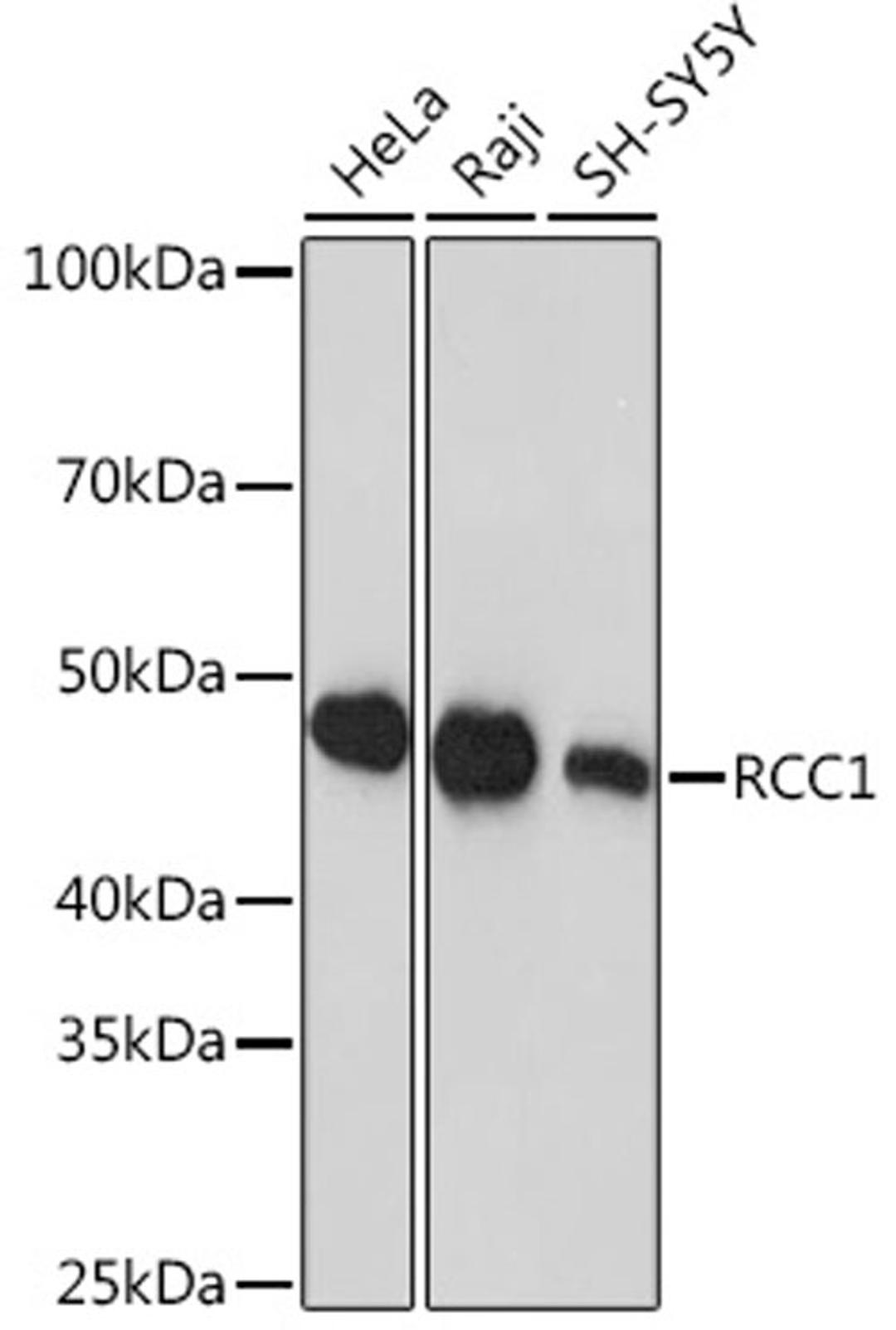 Western blot - RCC1 Rabbit mAb (A0662)