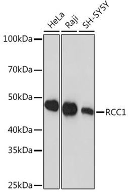 Western blot - RCC1 Rabbit mAb (A0662)