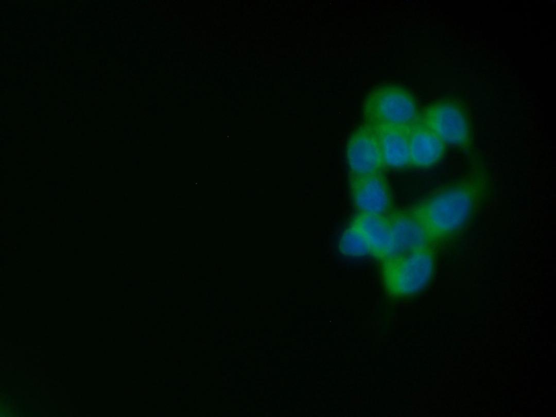 Immunofluorescence staining of MCF-7 cells with Mouse anti Human CD227:FITC