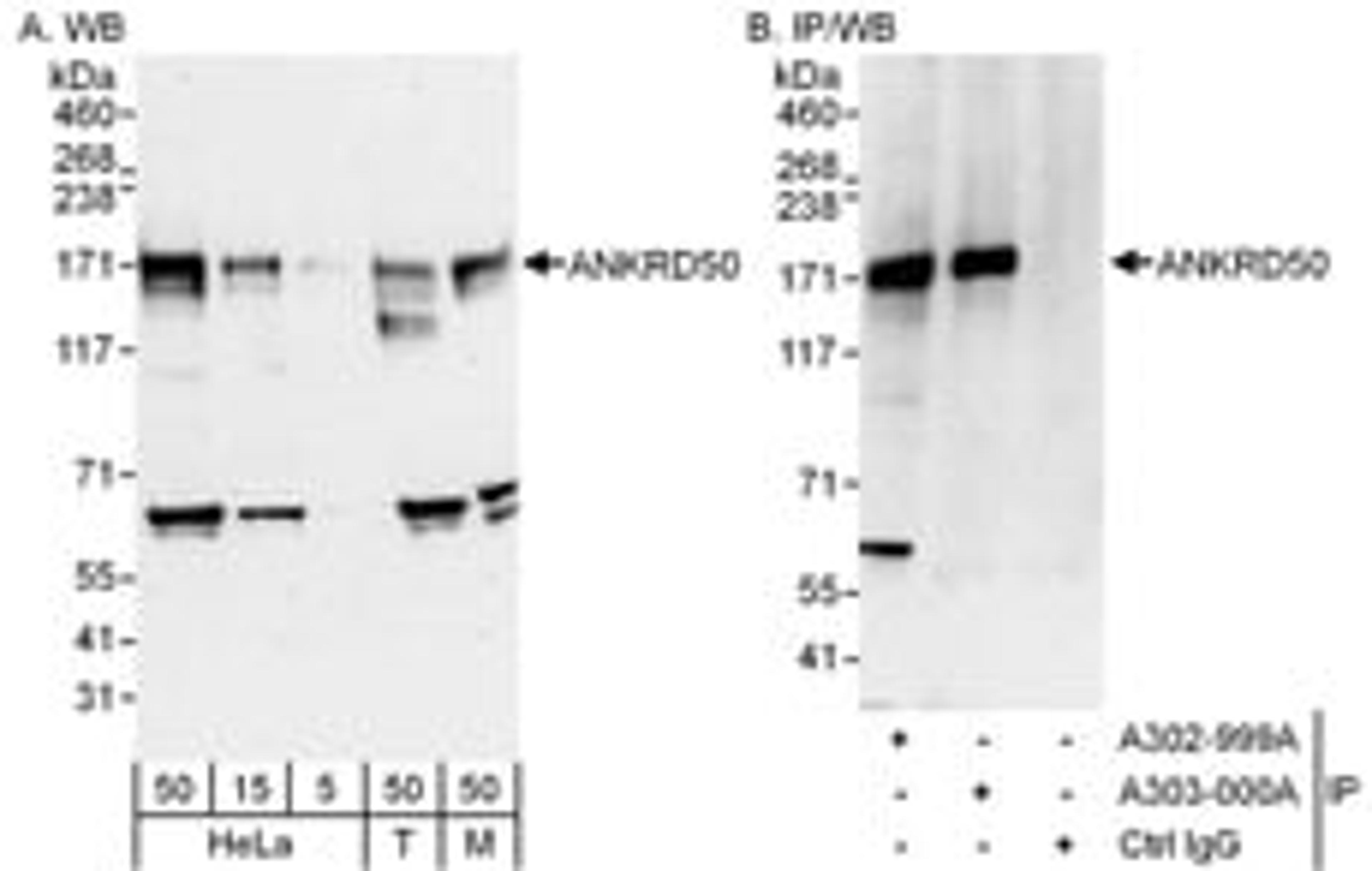 Detection of human and mouse ANKRD50 by western blot (h&m) and immunoprecipitation (h).