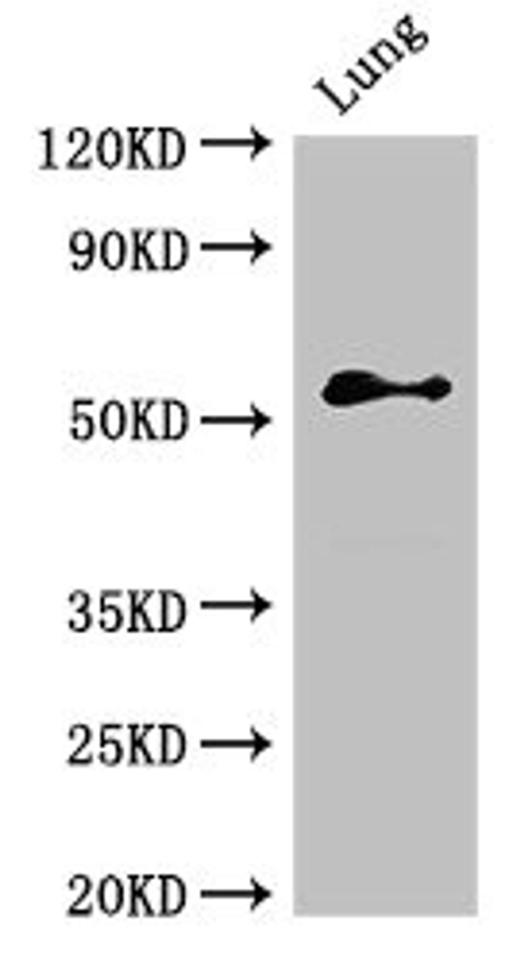 Western Blot. Positive WB detected in: Rat lung tissue. All lanes: BMPR1B antibody at 2.4ug/ml. Secondary. Goat polyclonal to rabbit IgG at 1/50000 dilution. Predicted band size: 57, 61 kDa. Observed band size: 57 kDa. 