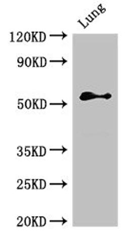 Western Blot. Positive WB detected in: Rat lung tissue. All lanes: BMPR1B antibody at 2.4ug/ml. Secondary. Goat polyclonal to rabbit IgG at 1/50000 dilution. Predicted band size: 57, 61 kDa. Observed band size: 57 kDa. 