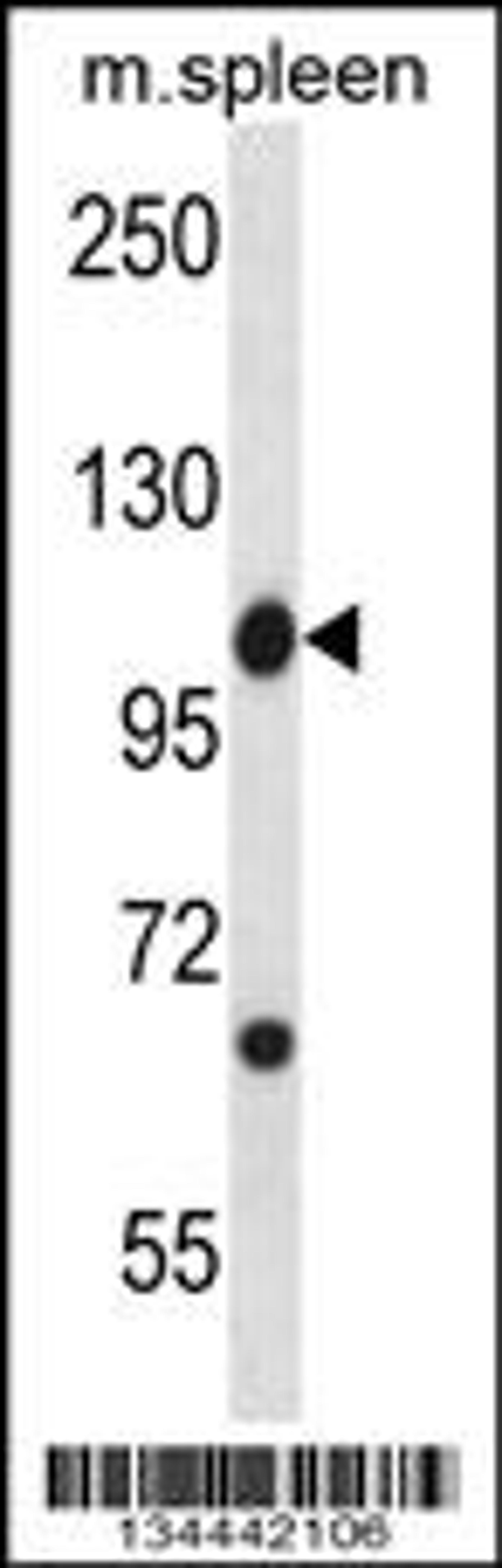 Western blot analysis in mouse spleen tissue lysates (35ug/lane).