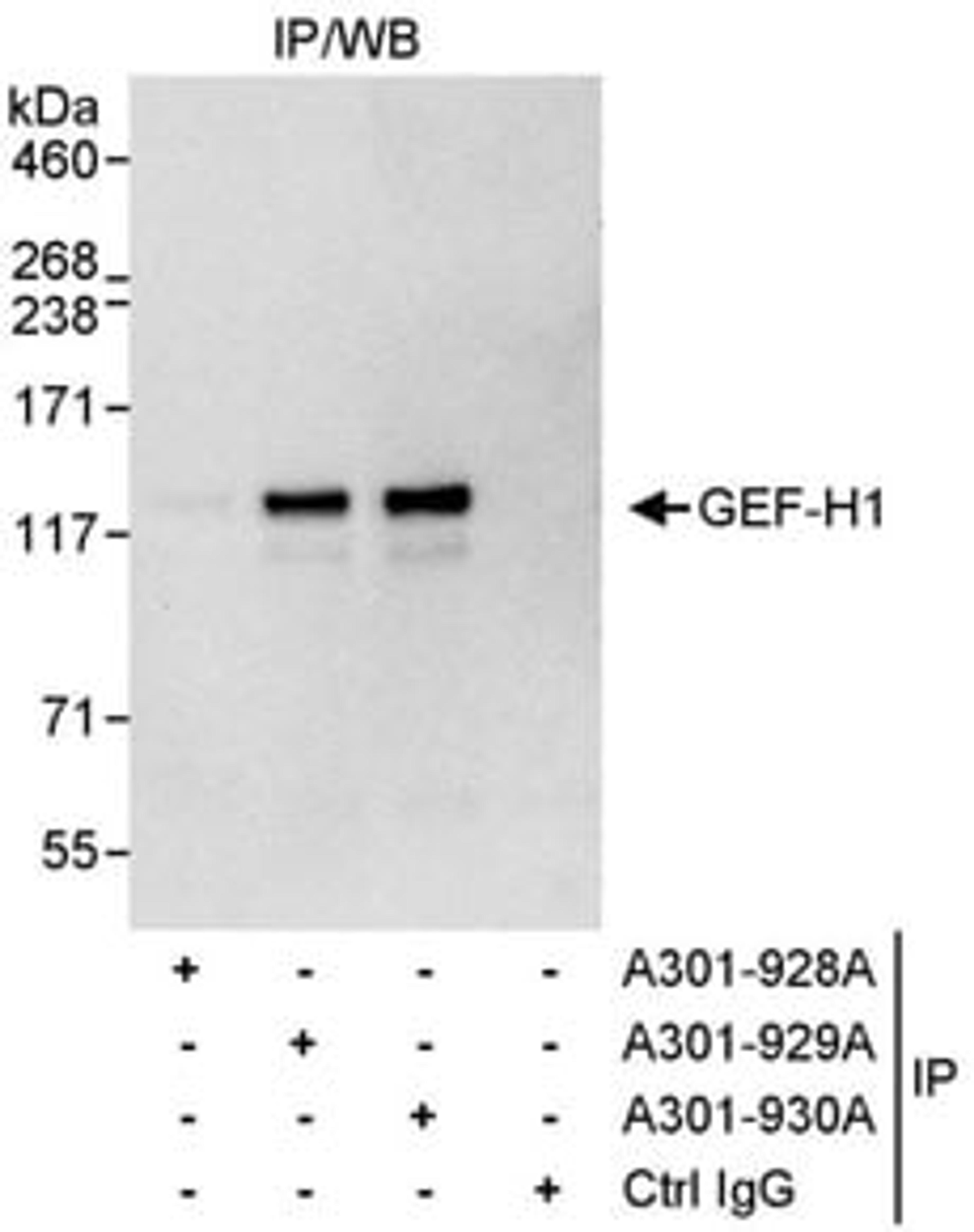 Detection of human GEF-H1 by western blot of immunoprecipitates.