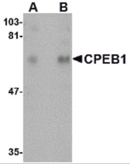 Western blot analysis of CPEB1 in rat brain tissue lysate with CPEB1 antibody at (A) 1 and (B) 2 &#956;g/mL.