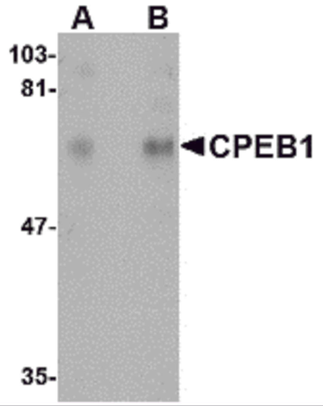 Western blot analysis of CPEB1 in rat brain tissue lysate with CPEB1 antibody at (A) 1 and (B) 2 μg/mL.