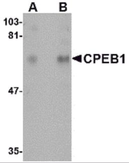 Western blot analysis of CPEB1 in rat brain tissue lysate with CPEB1 antibody at (A) 1 and (B) 2 μg/mL.