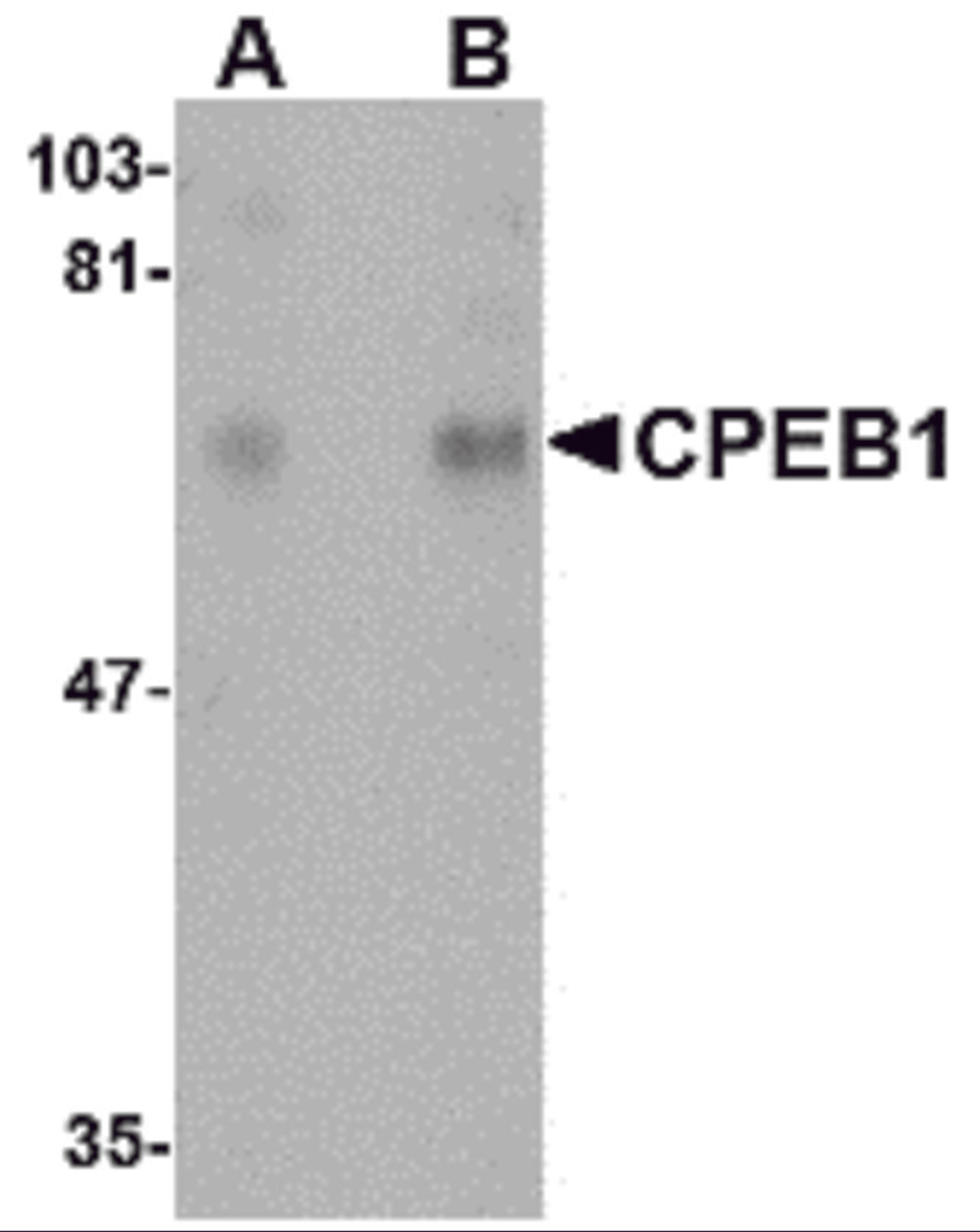 Western blot analysis of CPEB1 in rat brain tissue lysate with CPEB1 antibody at (A) 1 and (B) 2 μg/mL.