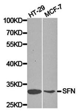 Western blot analysis of extracts of various cell lines lysates using SFN antibody