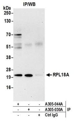 Detection of human RPL18A by western blot of immunoprecipitates.