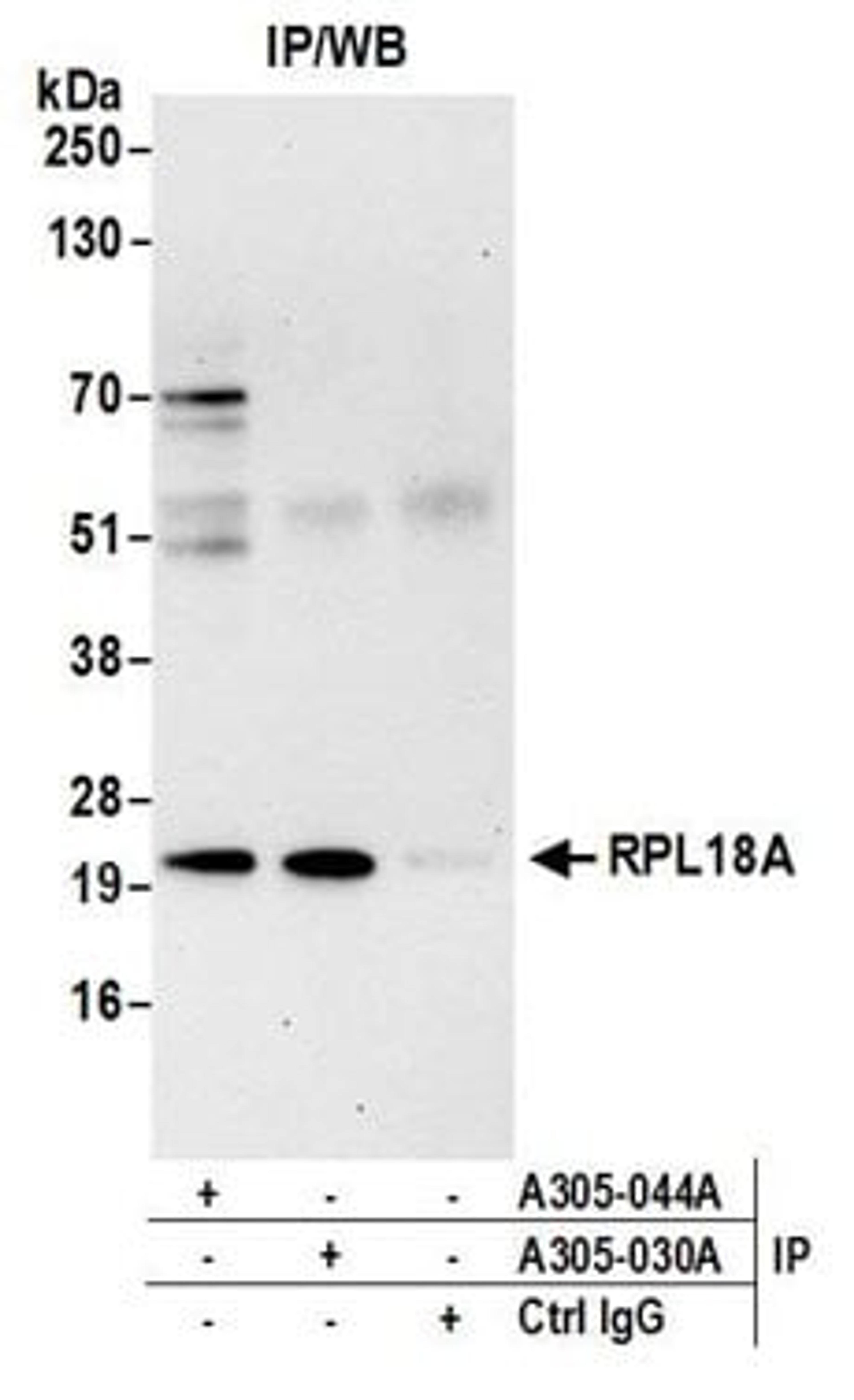 Detection of human RPL18A by western blot of immunoprecipitates.