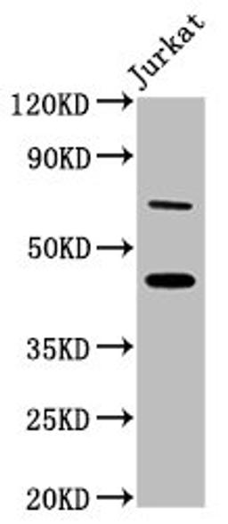 Western Blot. Positive WB detected in: Jurkat whole cell lysate. All lanes: ERI1 antibody at 7ug/ml. Secondary. Goat polyclonal to rabbit IgG at 1/50000 dilution. Predicted band size: 41 kDa. Observed band size: 46 kDa. 