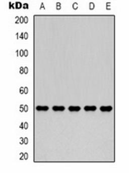 Western blot analysis of 293T (Lane 1), HepG2 (Lane 2), Hela (Lane 3), mouse brain (Lane 4), rat brain (Lane 5) whole cell lysates using Fumarase antibody