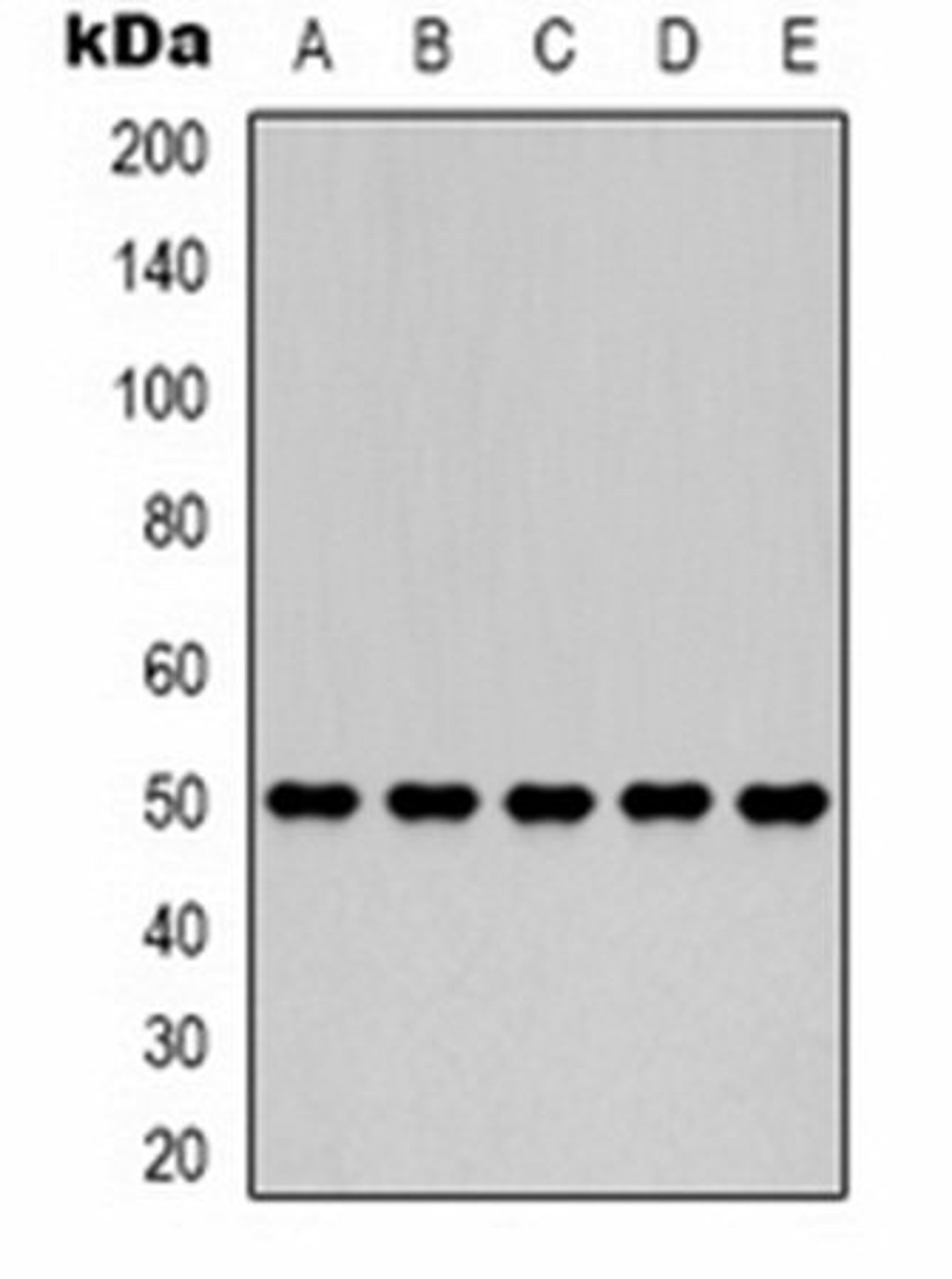 Western blot analysis of 293T (Lane 1), HepG2 (Lane 2), Hela (Lane 3), mouse brain (Lane 4), rat brain (Lane 5) whole cell lysates using Fumarase antibody