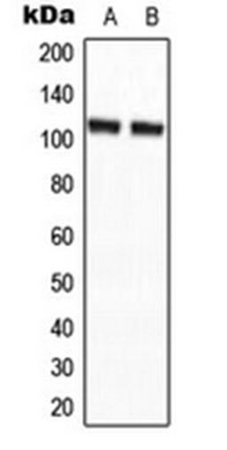 Western blot analysis of HepG2 (Lane 1), NIH3T3 (Lane 2) whole cell lysates using CCP2 antibody