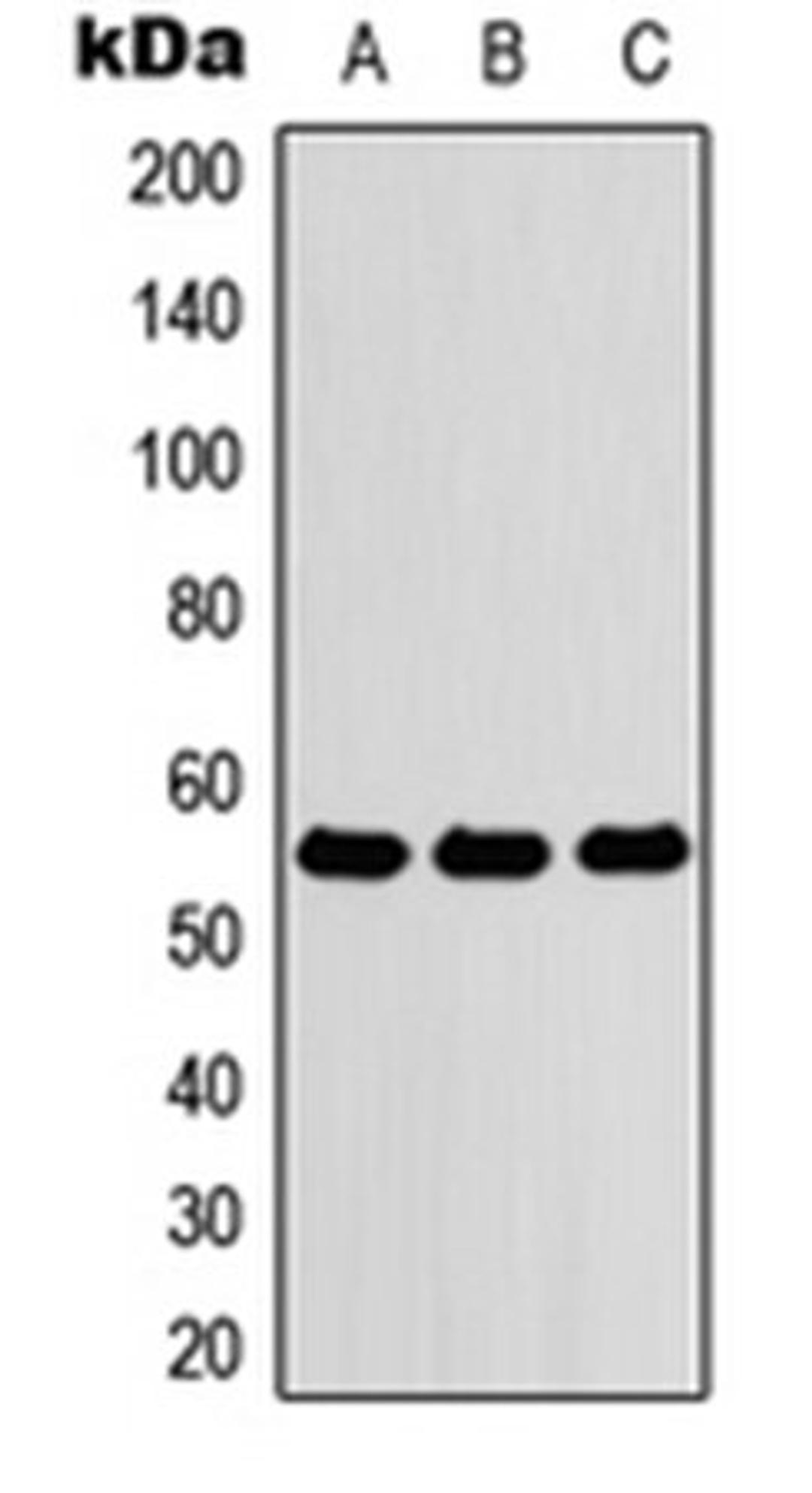 Western blot analysis of HEK293T (Lane 1), Raw264.7 (Lane 2), PC12 (Lane 3) whole cell lysates using ZNF76 antibody