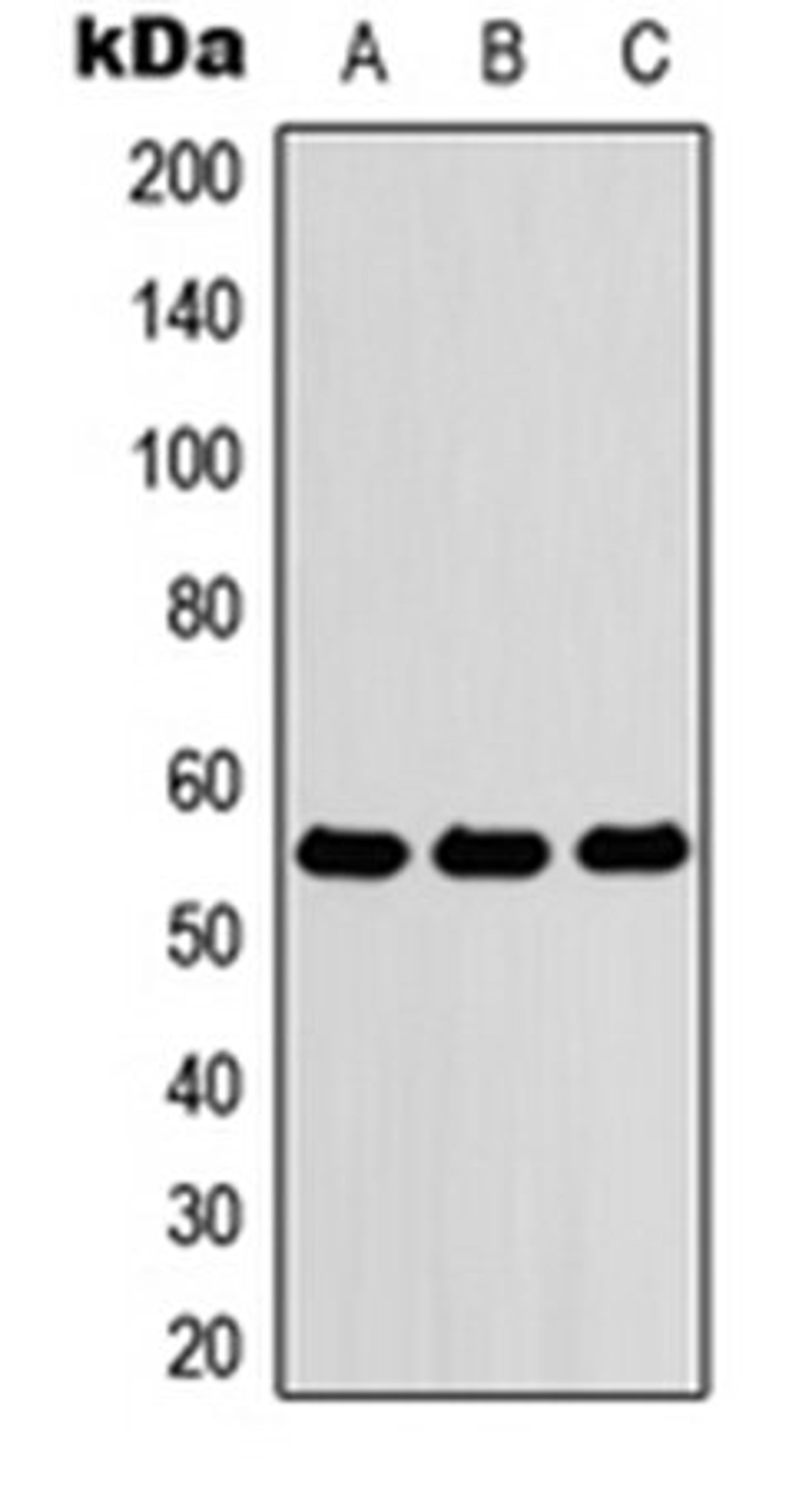 Western blot analysis of HEK293T (Lane 1), Raw264.7 (Lane 2), PC12 (Lane 3) whole cell lysates using ZNF76 antibody