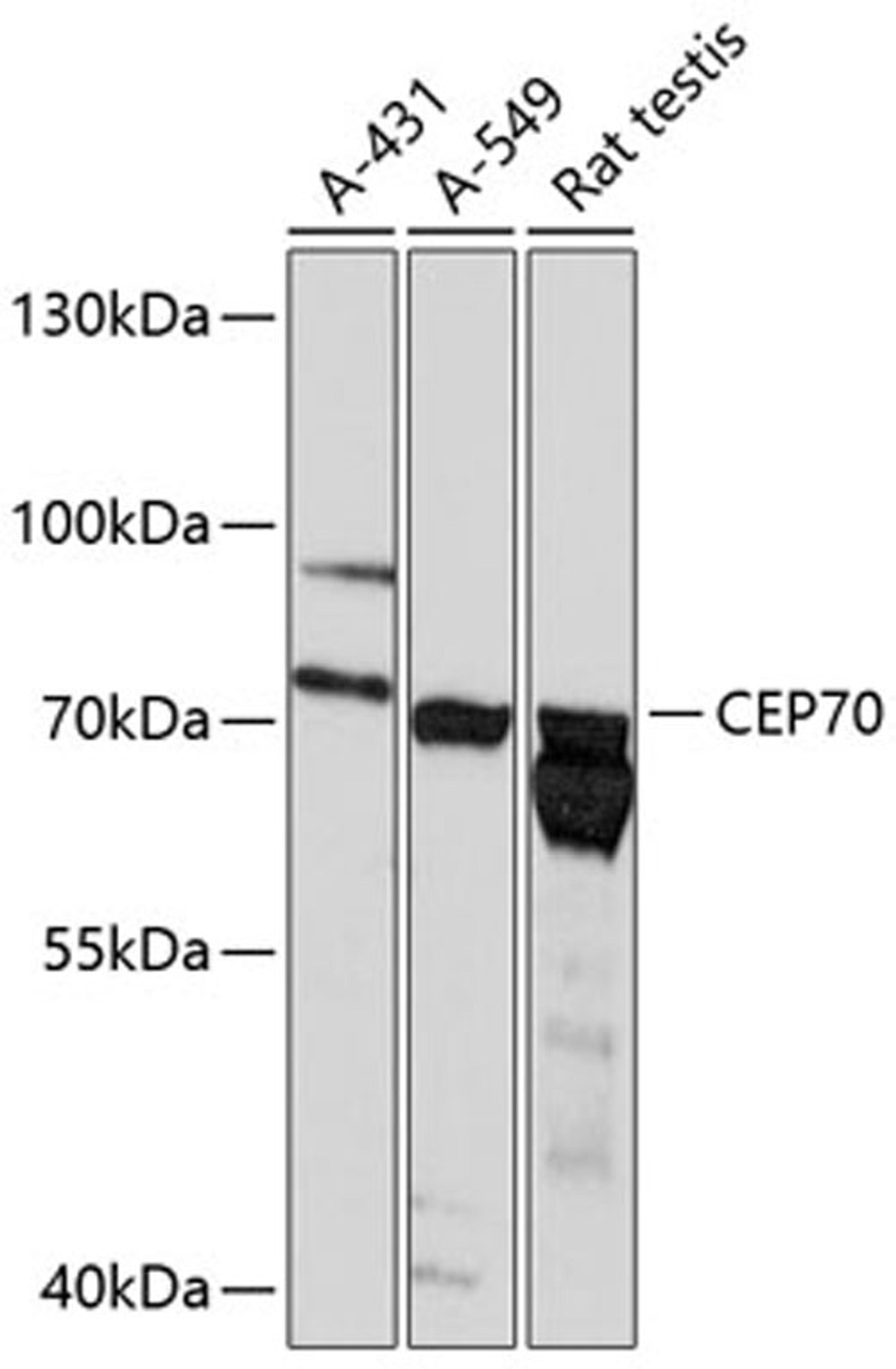 Western blot - CEP70 antibody (A13883)